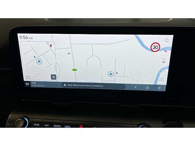 Hyundai Kona KONA 160kW Ultimate 65kWh 5dr Auto